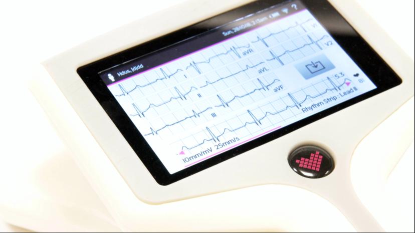 Portable ECG Monitor